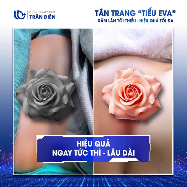 Làm đẹp từ bên trong – Tự tin từ bên ngoài